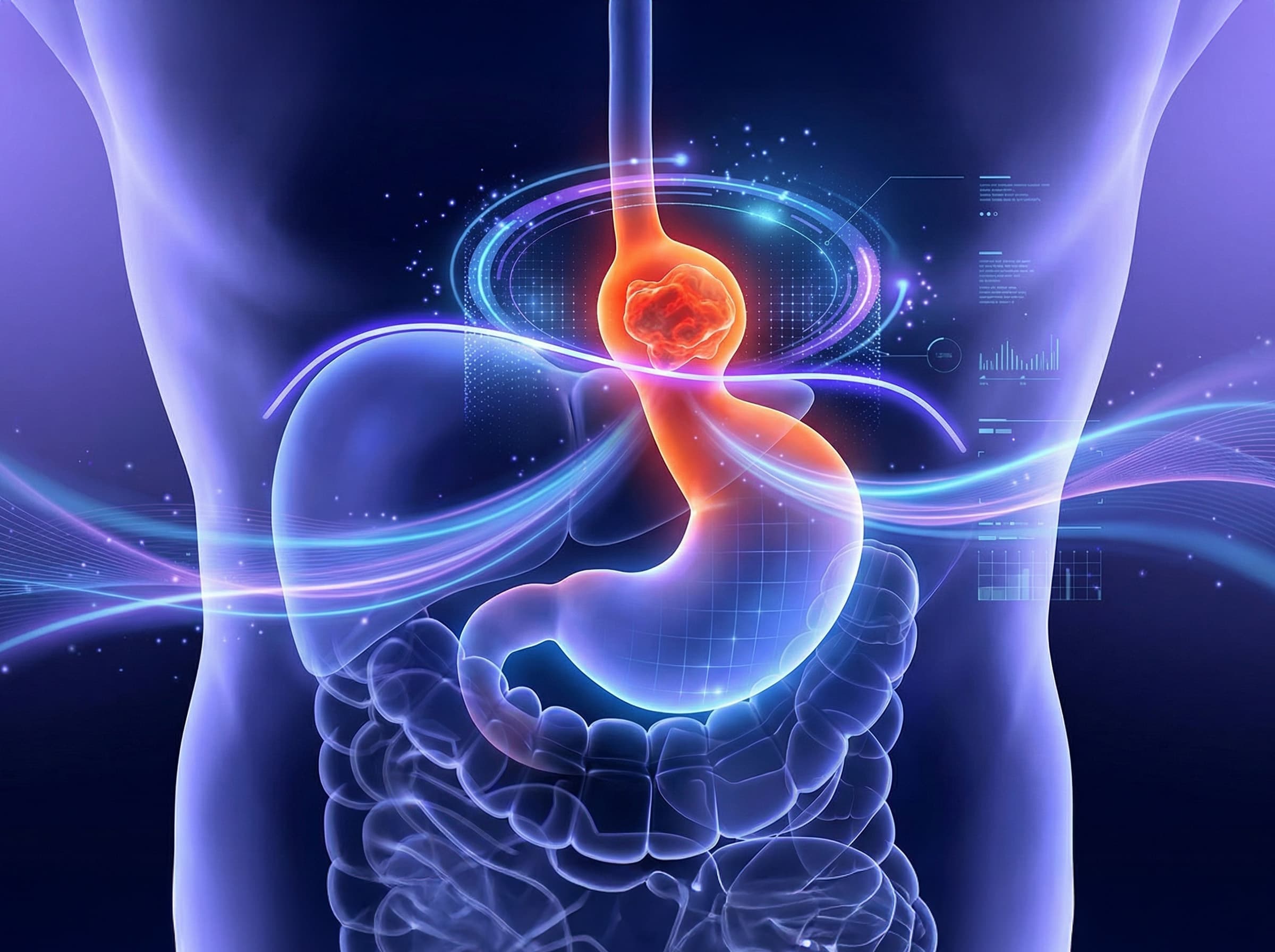 Laparoscopic Hiatal Hernia Repair