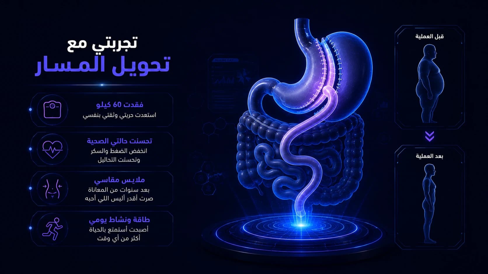تجربتي مع تحويل المسار: المميزات والعيوب من واقع التجربة