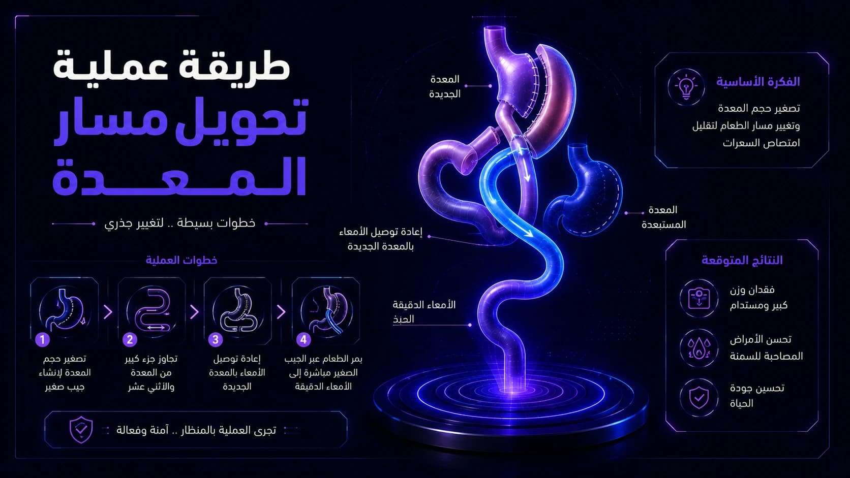 طريقة عملية تحويل مسار المعدة | ماذا يحدث أثناء الجراحة؟