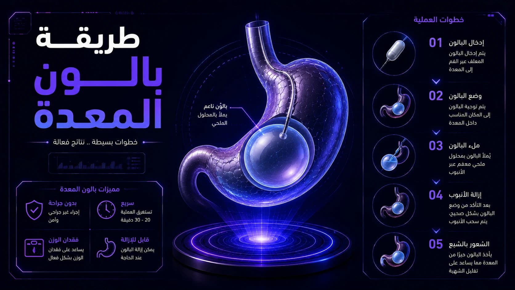 طريقة بالون المعدة | خطوات الإجراء بالتفصيل