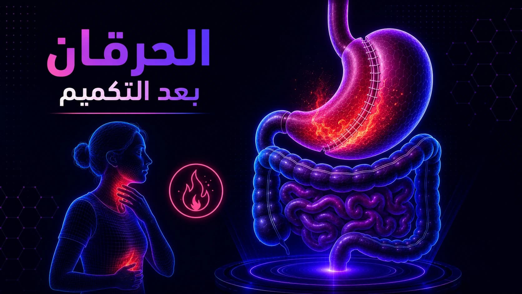 الحرقان بعد التكميم | أسباب الحموضة وطرق التخلص منها