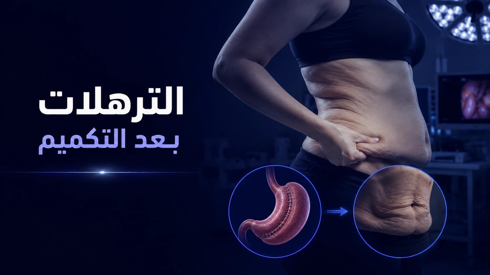 الترهلات بعد التكميم | أسباب ترهل الجلد وطرق علاجه