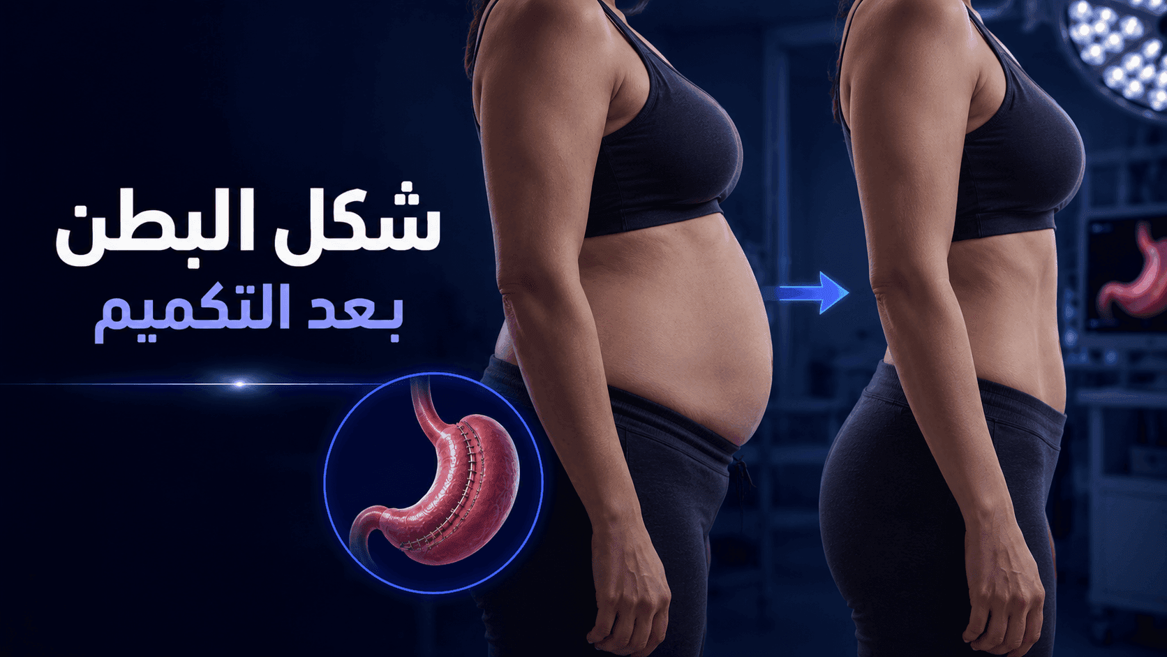شكل البطن بعد عملية التكميم | التغيرات الطبيعية والمتوقعة