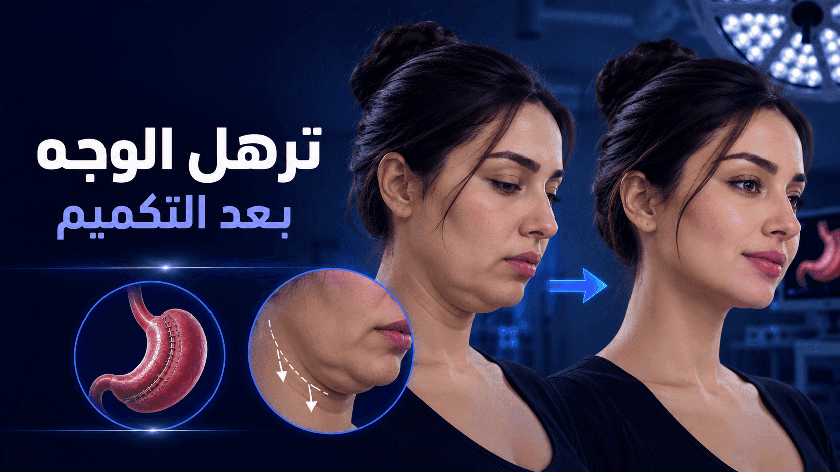 ترهل الوجه بعد التكميم | الأسباب وطرق العلاج